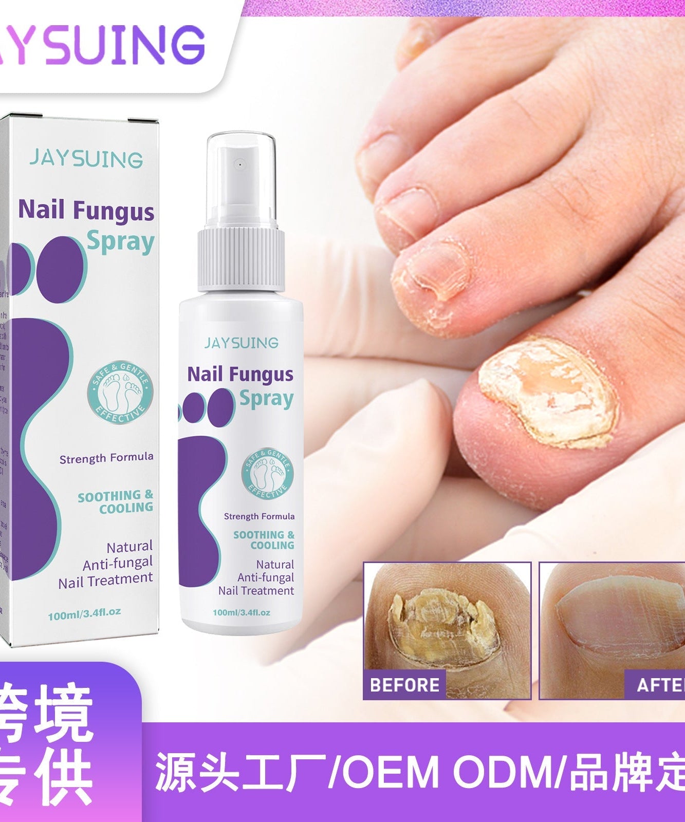Jaysuin - Nail Fungus Spray (Original)